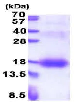 SDS-PAGE - Recombinant Human ZNDR1 protein (His tag N-Terminus) (AB176045)