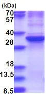 SDS-PAGE - Recombinant Human ZNF32 protein (denatured) (AB181934)