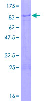 SDS-PAGE - Recombinant Human ZNF358 protein (AB165455), expandable thumbnail