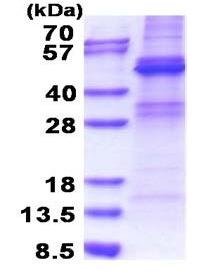 SDS-PAGE - Recombinant Human ZNF514 protein (denatured) (His tag N-Terminus) (AB171495)