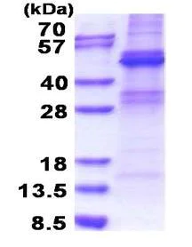 SDS-PAGE - Recombinant Human ZNF514 protein (denatured) (His tag N-Terminus) (AB171495)