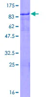 SDS-PAGE - Recombinant Human ZNFN1A2/HELIOS protein (AB161430)