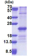 SDS-PAGE - Recombinant Human ZNHIT3 protein (denatured) (His tag N-Terminus) (AB171718)