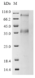 SDS-PAGE - Recombinant Human ZnT-8 protein (AB289751)