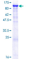 SDS-PAGE - Recombinant Human ZP2 protein (AB159886), expandable thumbnail