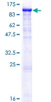 SDS-PAGE - Recombinant Human ZP2 protein (GST tag N-Terminus) (AB159886)