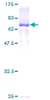 Recombinant Human ZPI protein