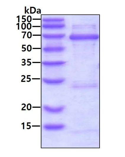 SDS-PAGE - Recombinant Human ZWILCH protein (His tag N-Terminus) (AB181888)