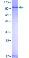 SDS-PAGE - Recombinant Human Zyxin protein (AB132079)