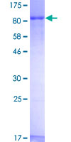 SDS-PAGE - Recombinant Human Zyxin protein (GST tag N-Terminus) (AB132079)
