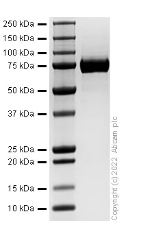 SDS-PAGE - Recombinant Influenza A H1N1 Hemagglutinin Protein (His-tag) (AB307788)