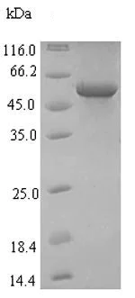 SDS-PAGE - Recombinant Influenza A Hemagglutinin protein (His tag) (AB225645)