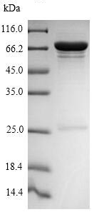 Recombinant Influenza A Influenza A Virus Nucleoprotein (His tag)