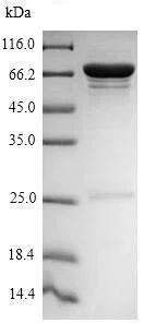 SDS-PAGE - Recombinant Influenza A Influenza A Virus Nucleoprotein (His tag) (AB224859)