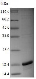 SDS-PAGE - Recombinant Influenza A Polymerase acidic protein (His tag) (AB239539), expandable thumbnail