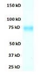 SDS-PAGE - Recombinant Influenza A Virus Hemagglutinin H3 protein (His tag) (AB217642), expandable thumbnail
