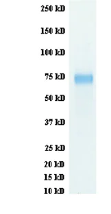 SDS-PAGE - Recombinant Influenza A Virus Hemagglutinin H3 protein (His tag) (AB217661)