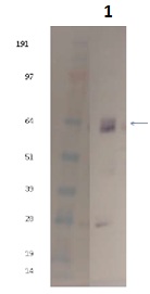 Western blot - Recombinant Influenza A Virus Hemagglutinin H5 protein (AB190125), expandable thumbnail