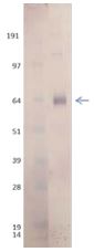 Western blot - Recombinant Influenza A Virus Hemagglutinin H7 protein (AB190421), expandable thumbnail