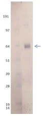 Western blot - Recombinant Influenza A Virus Hemagglutinin H7 protein (AB190421)