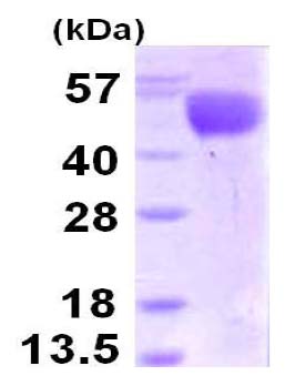 SDS-PAGE - Recombinant Influenza A Virus Hemagglutinin protein (AB124596), expandable thumbnail