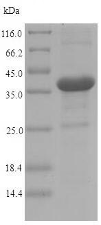 SDS-PAGE - Recombinant Invasin protein (His tag) (AB224847), expandable thumbnail