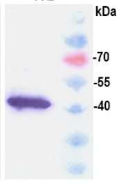 Recombinant JCV Polyomavirus Major Capsid VP1 protein
