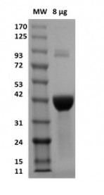 Recombinant L-methionine gamma-lyase Active protein (mutated F47L + D172E + S308Y)