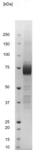 SDS-PAGE - Recombinant Lassa Fever Virus GP1 glycoprotein (Fc Chimera) (AB256441)