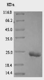 SDS-PAGE - Recombinant Leiurus quinquestriatus Alpha-insect toxin LqhaIT protein (His tag) (AB224837)