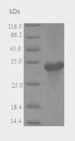 SDS-PAGE - Recombinant Major allergen Mal d 1 protein (His tag) (AB226280)