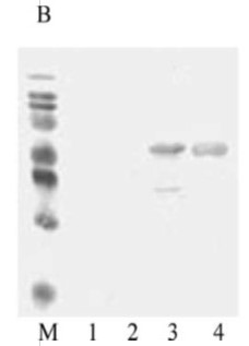 Western blot - Recombinant Measles virus Priorix, Schwarz strain, nucleocapsid protein (AB74559), expandable thumbnail