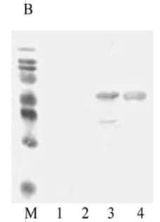 Western blot - Recombinant Measles virus Priorix, Schwarz strain, nucleocapsid protein (AB74559)