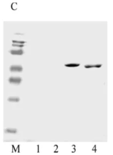 Western blot - Recombinant Measles virus Priorix, Schwarz strain, nucleocapsid protein (AB74559)