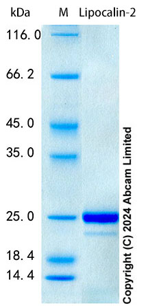 SDS-PAGE - Recombinant Monkey Lipocalin-2 Protein Standard (His tag) (AB322751), expandable thumbnail
