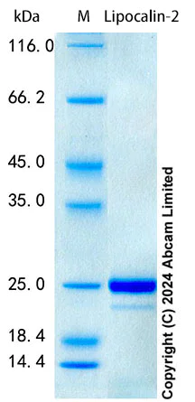 SDS-PAGE - Recombinant Monkey Lipocalin-2 Protein Standard (His tag) (AB322751)