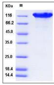 SDS-PAGE - Recombinant Mouse ACE2 protein (Fc Chimera His Tag) (AB276801)