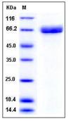 SDS-PAGE - Recombinant Mouse Acetylcholinesterase protein (His tag) (AB276869)