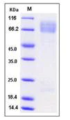 SDS-PAGE - Recombinant Mouse ADAM15 protein (His tag) (AB276960)