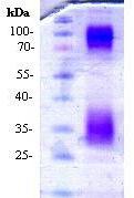 SDS-PAGE - Recombinant Mouse Adiponectin (mutated C39A) protein (AB94676)