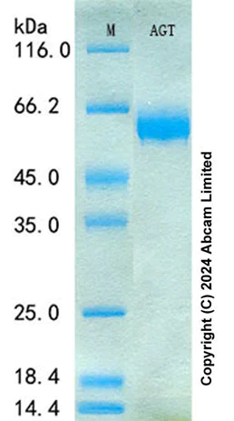 SDS-PAGE - Recombinant Mouse AGT Protein Standard (His tag) (AB322089)