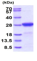 SDS-PAGE - Recombinant mouse AK 1 protein (Active) (AB227415)