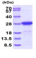 SDS-PAGE - Recombinant mouse AK 1 protein (Active) (His tag N-Terminus) (AB227415)