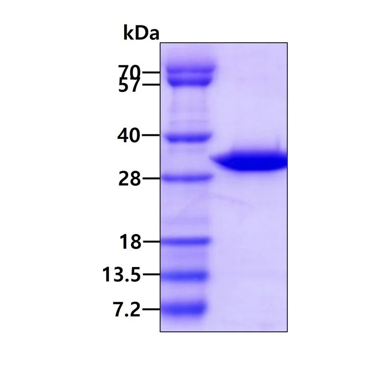 SDS-PAGE - Recombinant mouse AK2 protein (Active) (AB227417)