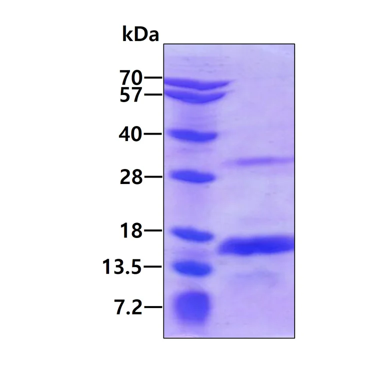 SDS-PAGE - Recombinant mouse AK2 protein (Active) (His tag N-Terminus) (AB227417)