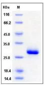 SDS-PAGE - Recombinant mouse AL-1 protein (His tag) (AB276882)