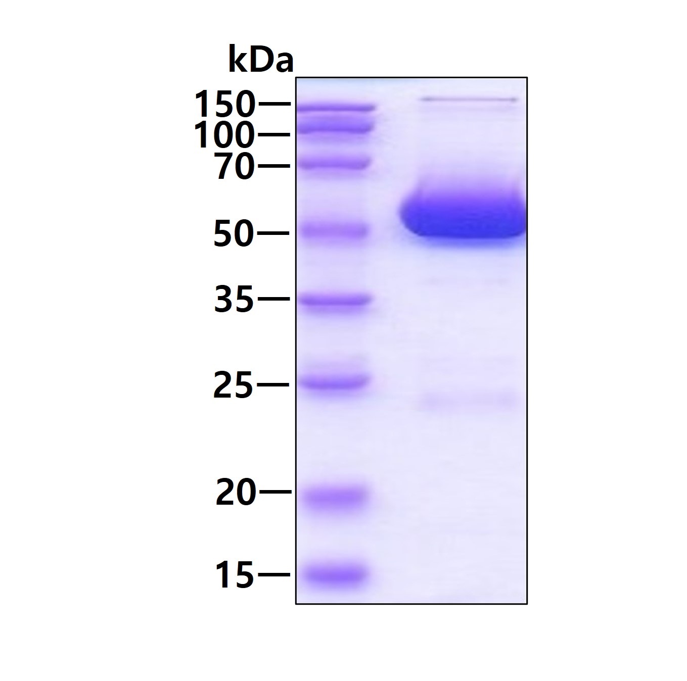 Recombinant mouse Alanine Transaminase protein (Active)