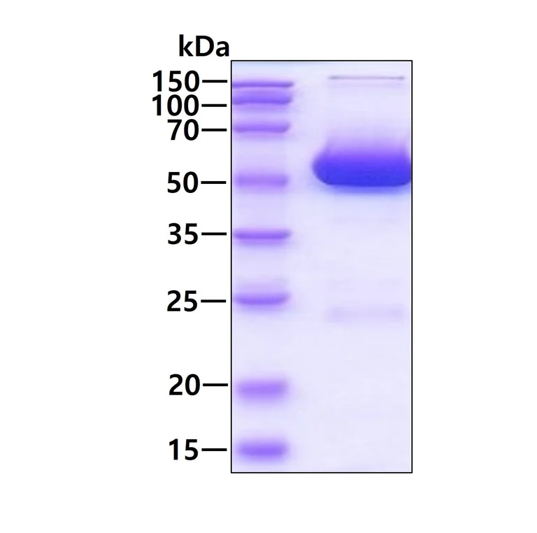 SDS-PAGE - Recombinant mouse Alanine Transaminase protein (Active) (His tag N-Terminus) (AB222953)