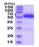 SDS-PAGE - Recombinant Mouse ALDH2 protein (His tag N-Terminus) (AB202237)
