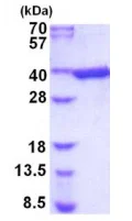 SDS-PAGE - Recombinant Mouse Aldose reductase protein (His tag N-Terminus) (AB202234)